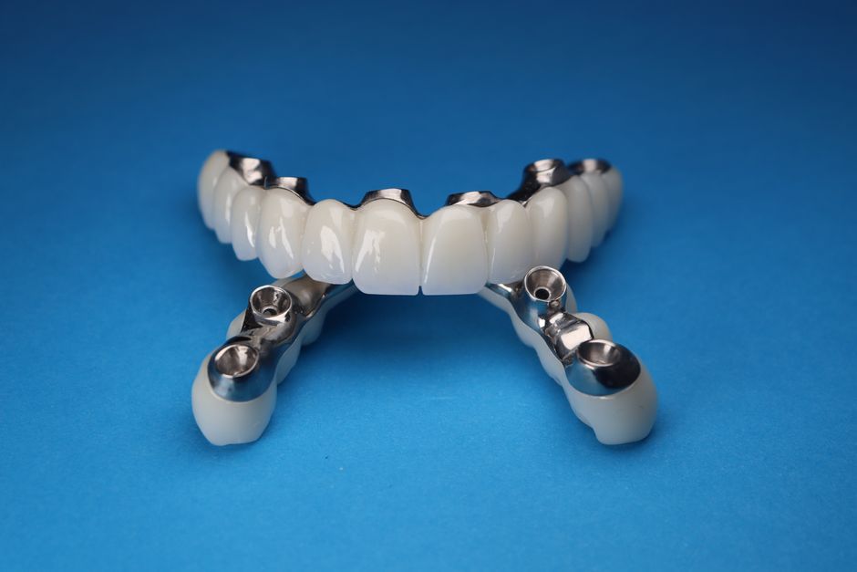 Implantul Dentar: O Soluție Modernă și Durabilă pentru Restaurarea Zâmbetului – Experiența Cris Smile