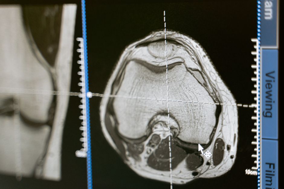 Imagistica medicală în diagnosticul precoce al cancerului